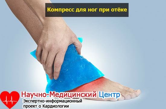 Отеки ног при сердечной недостаточности
