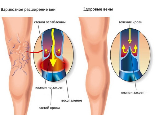 Аскорутин при ВСД – инструкция по применению, цена, отзывы