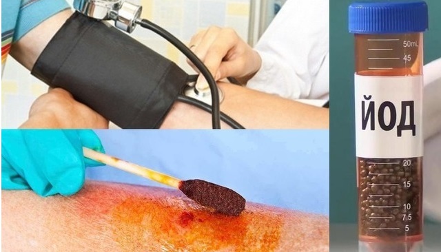 Лечение гипертонии йодом (по индийскому методу)
