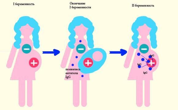 Чем опасен отрицательный резус-фактор у женщины?