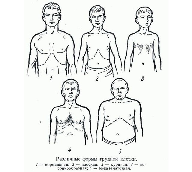 Топография грудной клетки. Границы грудной клетки