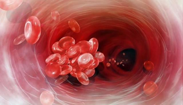 Как почистить сосуды в домашних условиях быстро и эффективно