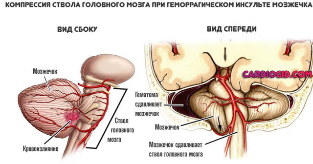 Антикоагулянты – механизм действия, список препаратов