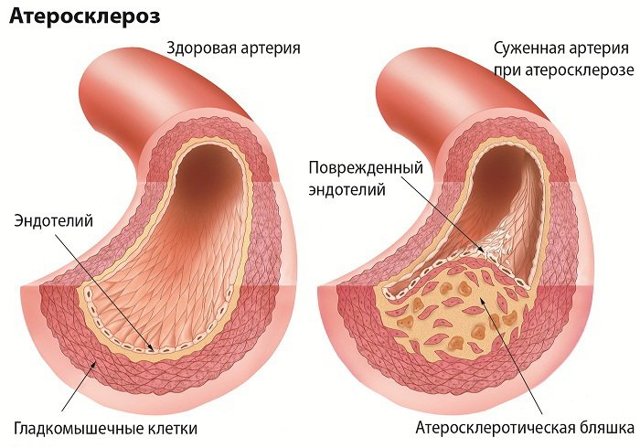 Тибетский рецепт очищения сосудов