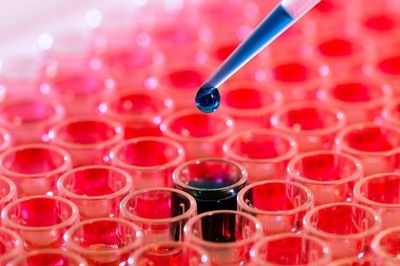 Повышены лейкоциты в крови: что это значит, причины