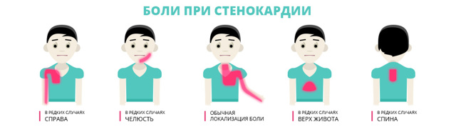 Полезные средства для лечения стенокардии в домашних условиях