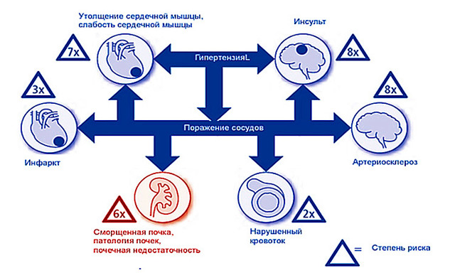 Что такое Артериальная гипертензия?