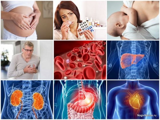 Препараты и народные средства для разжижения крови при варикозе