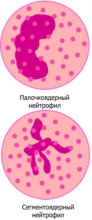 Палочкоядерные нейтрофилы: что это, норма, повышены