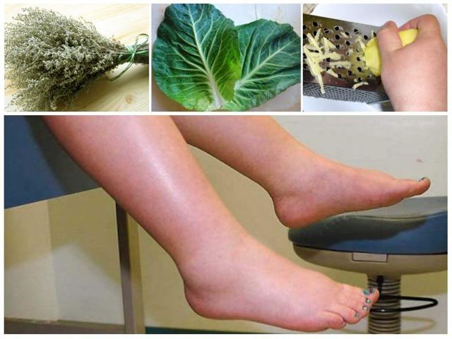 Отеки при варикозе - снимаем быстро и надолго