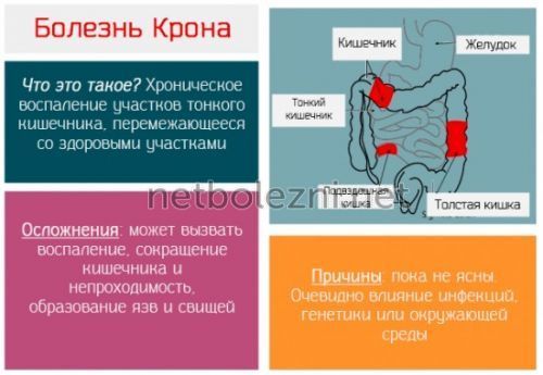 Черный налет на языке — начало больших проблем