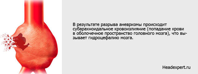Аневризма головного мозга: что такое, почему возникает, группы риска, классификация, симптомы, осложнения, последствия, диагностика, лечение