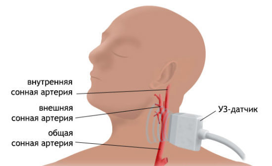 УЗДГ БЦА - что это такое. Особенности процедуры ЦДС сосудов головы и шеи