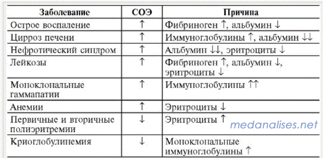 СОЭ и нормы скорости оседания эритроцитов в крови у женщин и детей