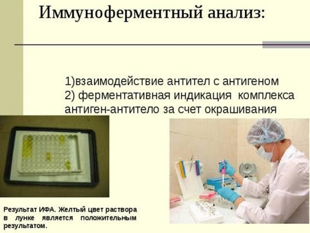 ИФА - иммуноферментный анализ крови: расшифровка
