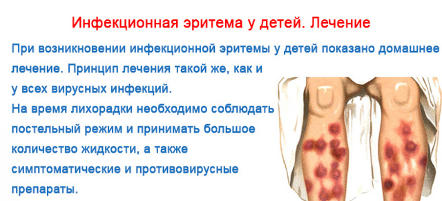 Эритема у детей и взрослых: симптомы, фото, лечение