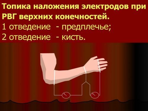 Что такое реовазография и как ее делают