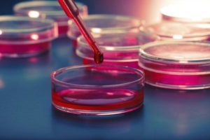 Как понизить билирубин в крови: лекарства и народные рецепты