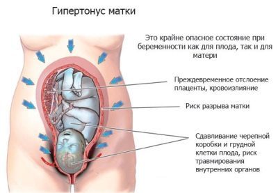 Как использовать свечи папаверин