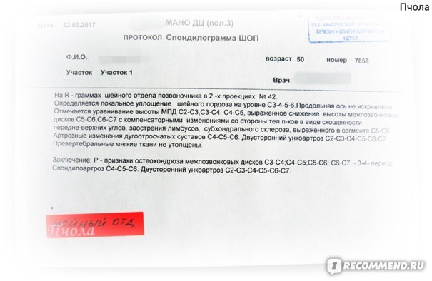 Артра цена от 928 руб, Артра купить в Москве, инструкция по применению, аналоги, отзывы