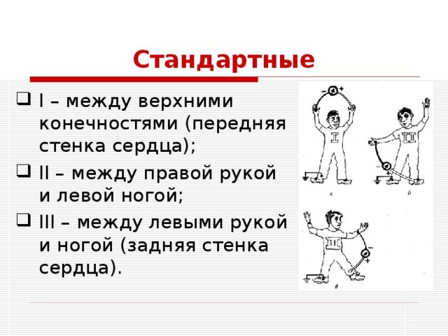Расшифровка ЭКГ в норме и при патологии. Уроки по ЭКГ с видео