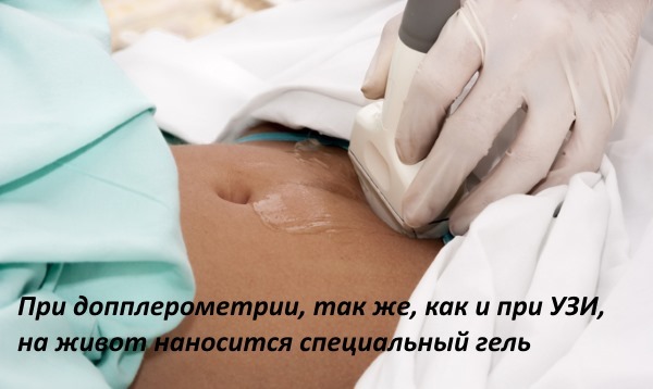 Нормы допплерографического исследования