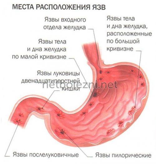 Кал черного цвета у взрослого - возможные причины
