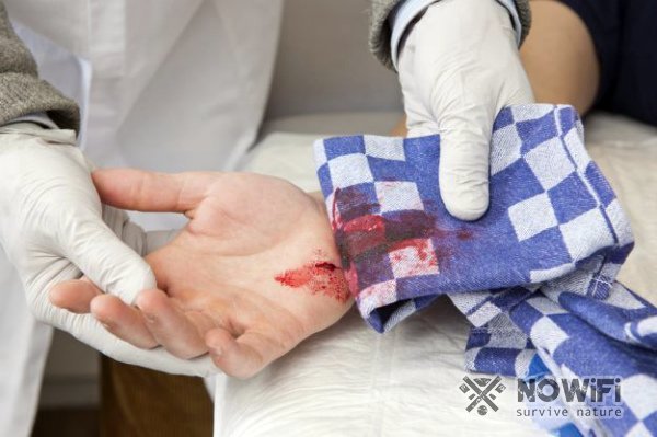 Кровоостанавливающие препараты