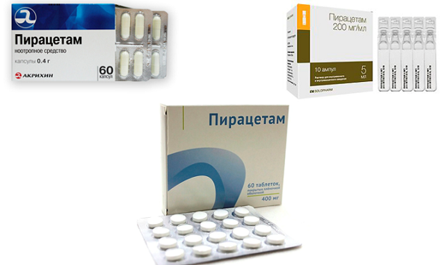 Сосуды головного мозга: заболевания, диагностика, лечение