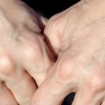 На лице видны вены что делать » Полезный блог обо всем