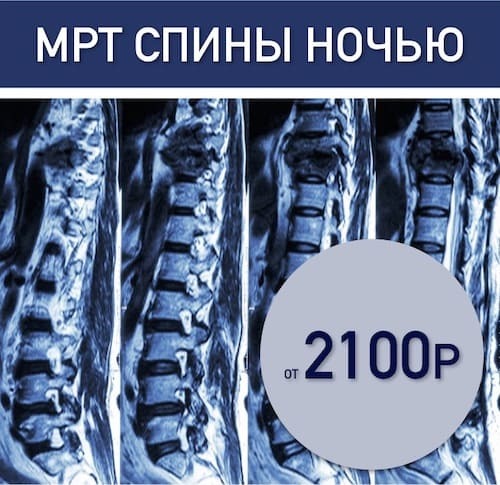 Сделать мр-венография головного мозга в Санкт-Петербурге - ICLINIC