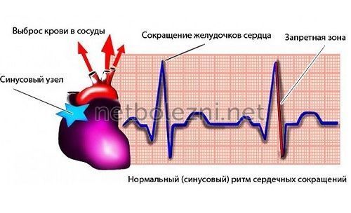 Брадикардия симптомы и лечение, какие таблетки принимать?
