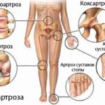 ХОНДРОИТИН: ИНСТРУКЦИЯ ПО ПРИМЕНЕНИЮ, ЦЕНА, ОТЗЫВЫ, АНАЛОГИ КАПСУЛ ХОНДРОИТИН