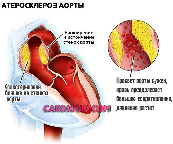 Почему давление высокое вечером. Почему повышается давление вечером. Народные методы лечения