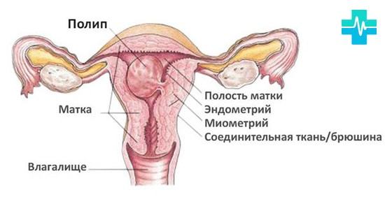 Выделения красные, но не месячные: причины