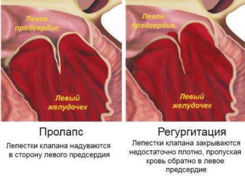 Аускультация сердца (выслушивание): точки, алгоритм, суть