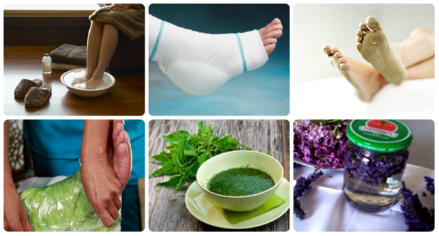 Пяточная шпора - симптомы и лечение в домашних условиях эффективными способами