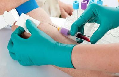 Общий белок в крови: норма у женщин и мужчин, причины повышенного и пониженного значения