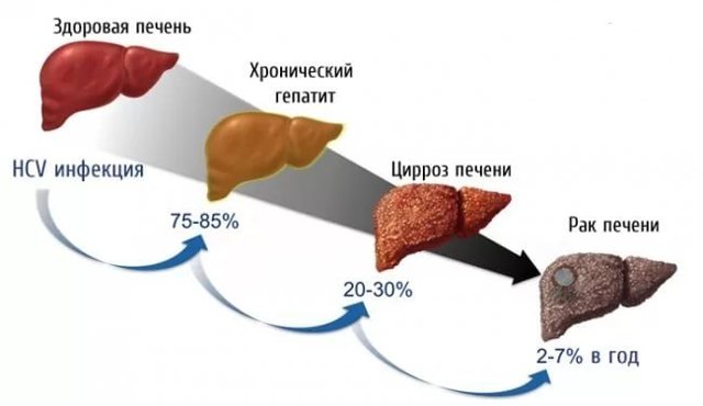 От чего повышен аст в анализе крови? Анализ крови аст повышен что это значит