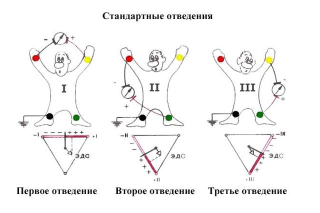Экг отведения по слопаку - Лечение гипертонии