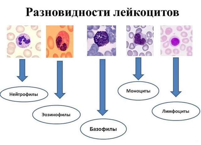 О чем это говорит, если базофилы повышены у взрослого