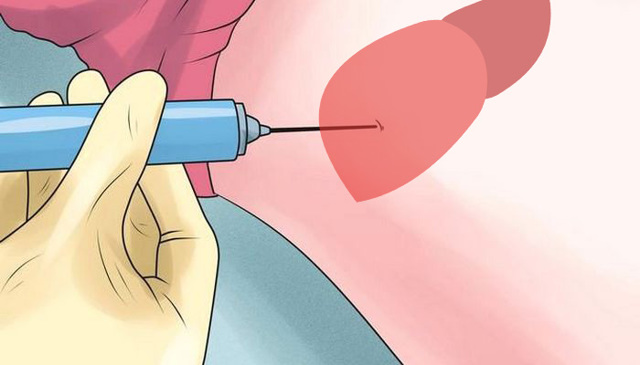 Соотношение аст и алт норма — Лечим печень