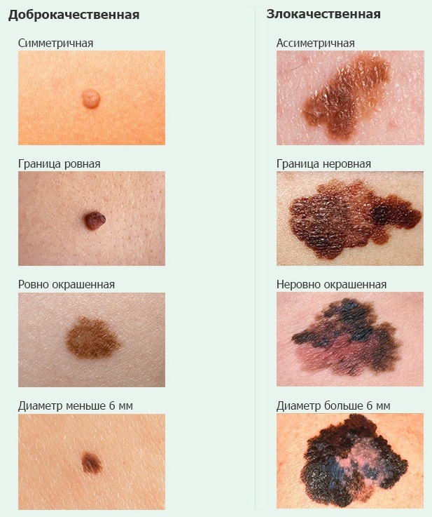 Красные пятна на теле у взрослого - появились красные пятнышки на лице