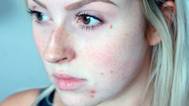 Мазь Бактробан: инструкция по применению для детей, отзывы, назальная мазь в нос