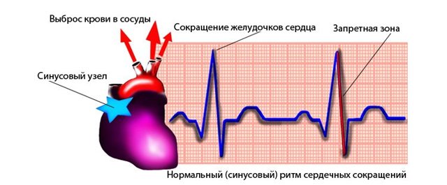 Синусовый ритм: что это в заключении ЭКГ, расшифровка и норма