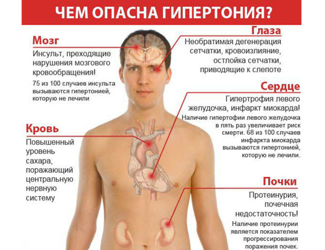 Стадии гипертонической болезни и риски