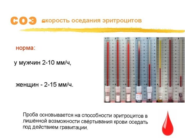 СОЭ: обозначение, норма, повышенный, пониженный, измерения