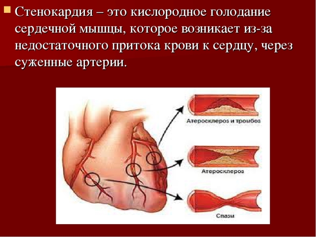 Боль в грудине слева: причины. Почему болит в левой части грудной клетки
