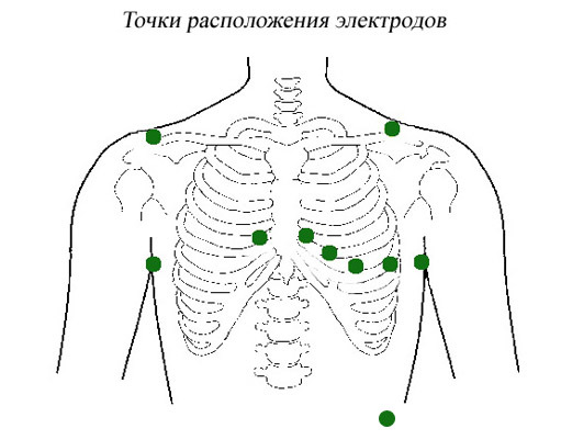 Техника снятия электрокардиограммы