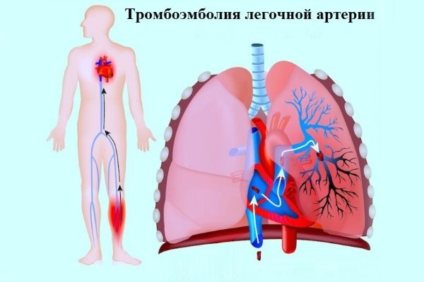 Болит сердце и тяжело дышать